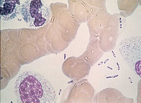 Мазок Yersinia pestis с биполярной окраской по типу булавки