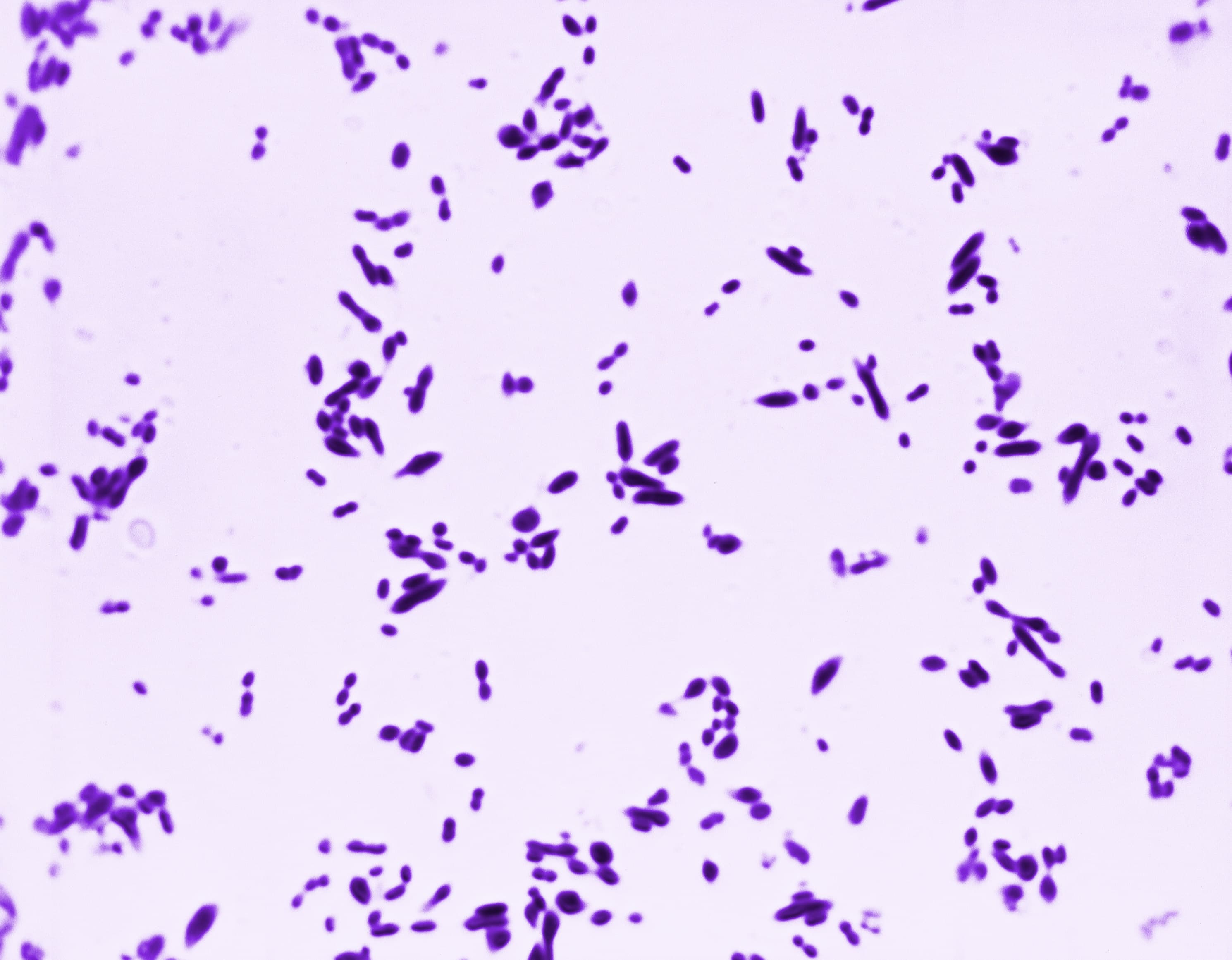 Микрофотография окраски по Граму с грамположительными диплококками Streptococcus pneumoniae