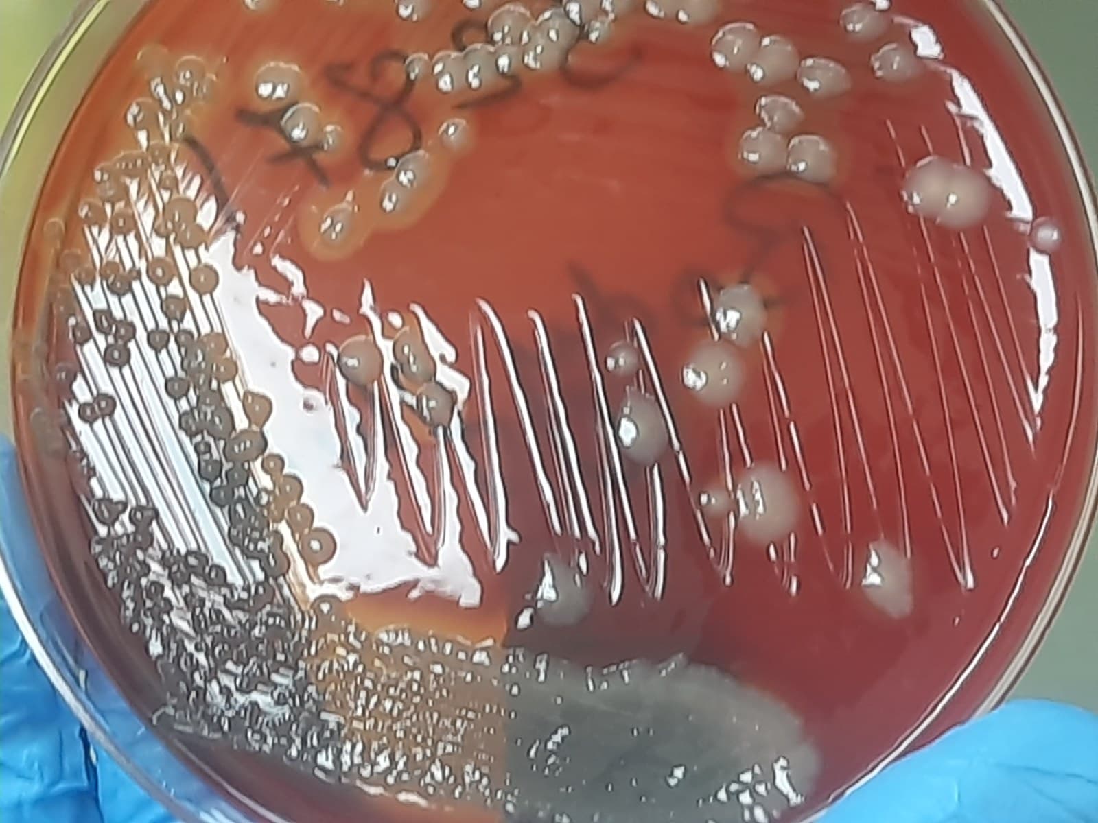 Placa de cultura com colônias de Pseudomonas aeruginosa e pigmento esverdeado.