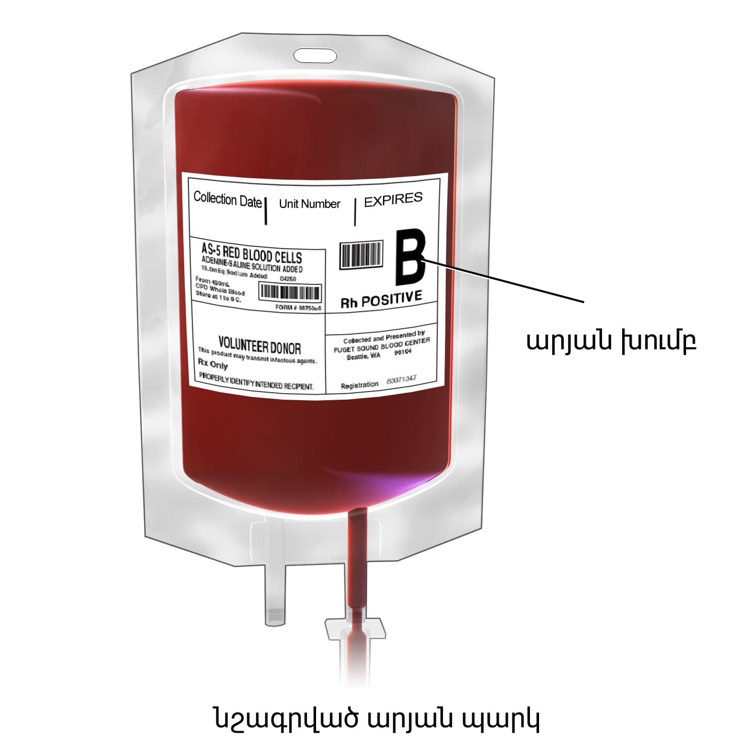 Ilustração de bolsa de sangue conectada a equipo para transfusão.