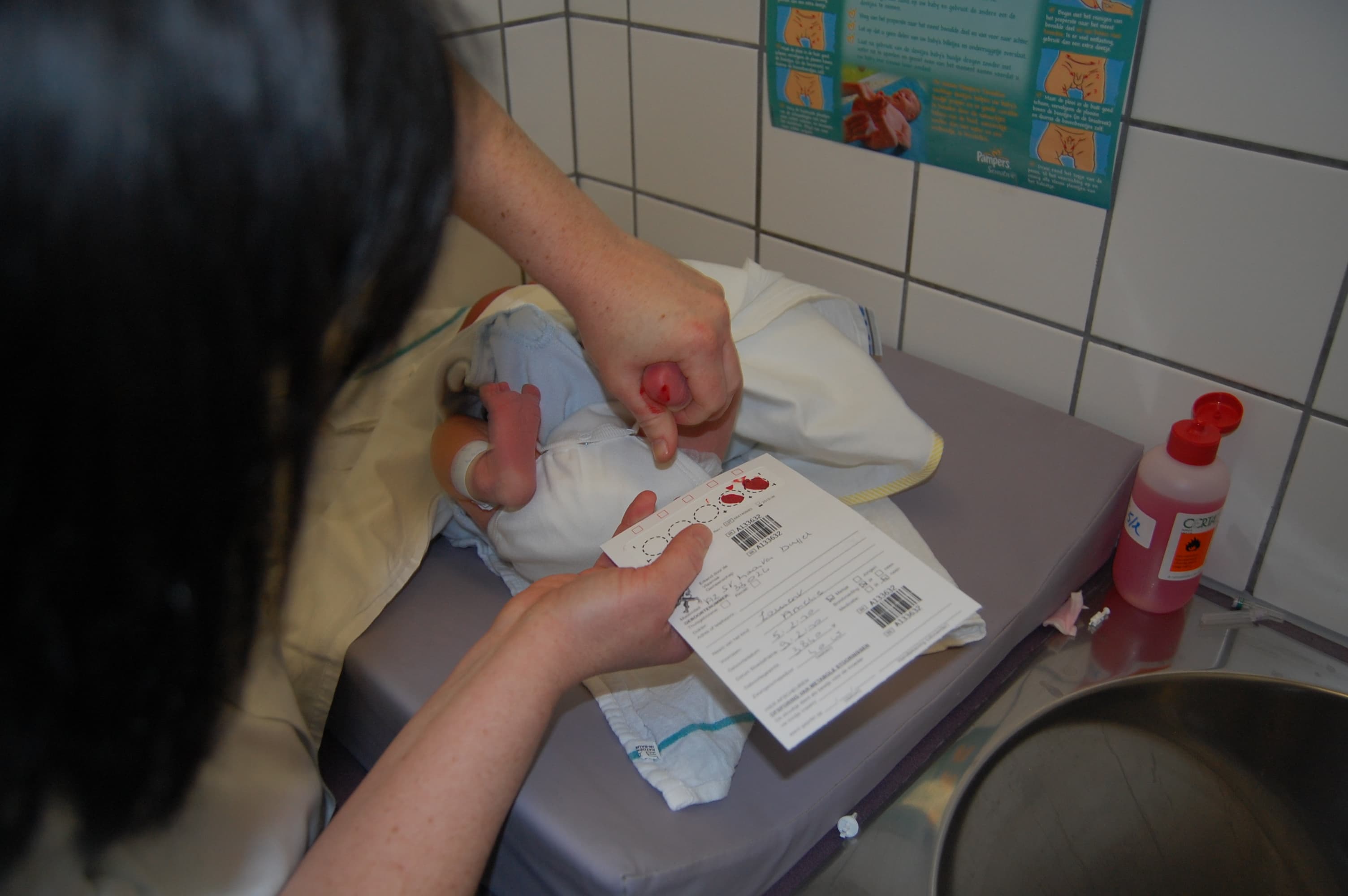 Teste do pezinho em Flandres, na Bélgica: uma mão segura o pé do recém-nascido, com a gota de sangue no calcanhar, e a outra segura o cartão de papel-filtro, com os círculos sendo preenchidos.